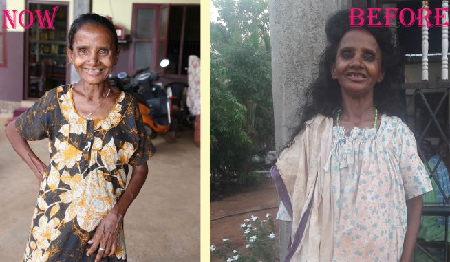 NMPC trust Undertaken woman wandering the streets
